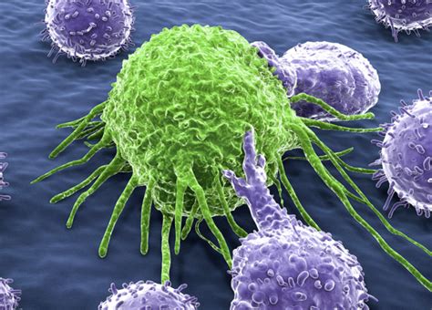 2020年ASCO免疫组合治疗,免疫联合治疗,NK细胞免疫疗法(SNK01)联合PD-1(K药)治疗晚期肺癌再添力证_全球肿瘤医生网