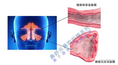 鼻腔解剖结构图图片