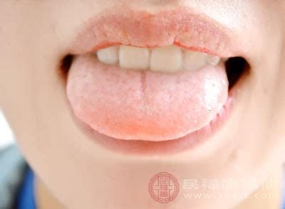 舌尖发麻是什么病兆 这些原因你要小心 - 民福康健康