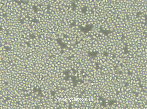 Sp2/O 小鼠骨髓瘤细胞-原代细胞-STR细胞-细胞培养基-赛百慷生物