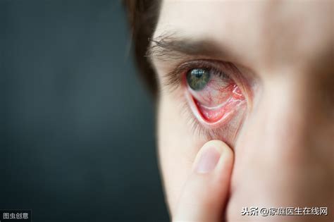 眼睛出现这5种症状, 可能你的肝脏已经受损严重, 这样调理可恢复!