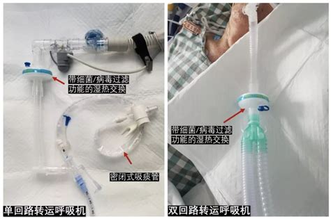 呼吸机管路连接图图片