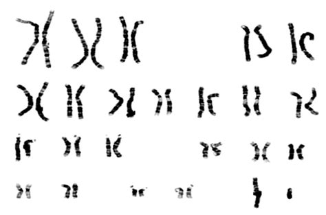 性染色体（决定个体雌雄性别的染色体）_摘编百科