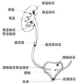 输尿管图片