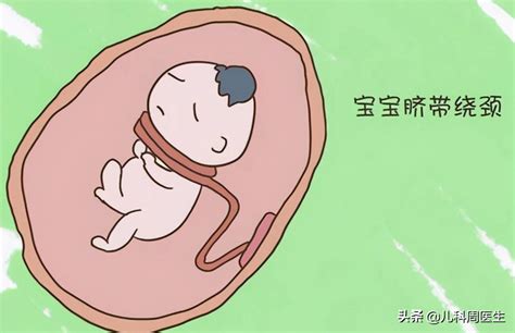 胎儿脐带绕颈可以顺产吗_百度宝宝知道-胎儿脐带绕颈两周 可以顺产吗