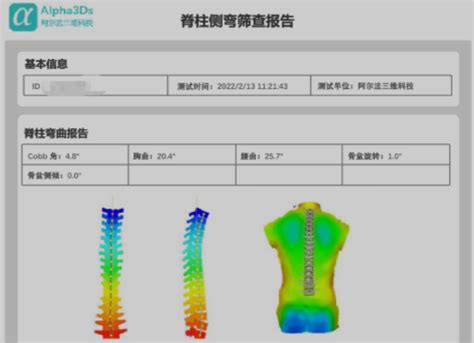 ENOVO人体脊柱模型脊椎骨盆整骨胸骨肋骨胸腔骼模骨架型-阿里巴巴