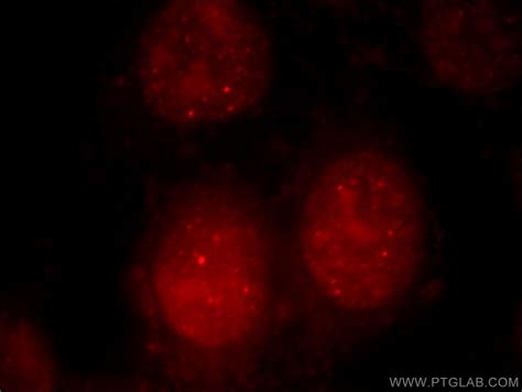 UBR2 Antibody 18853-1-AP | Proteintech