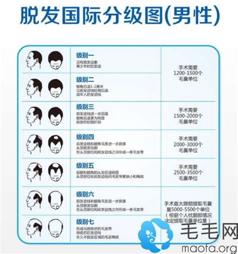 公布深圳正规的植发医院排名和各医院的毛发移植价格 - 热点资讯 - 毛毛网