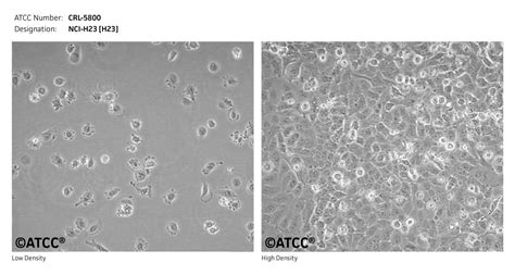 NCI-H23细胞ATCC CRL-5800细胞 H23人非小细胞肺癌腺癌细胞株购买价格、培养基、培养条件、细胞图片、特征等基本信息_生物风