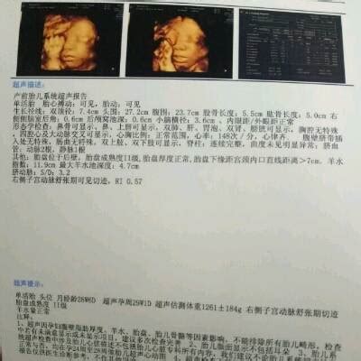 29周胎儿图片