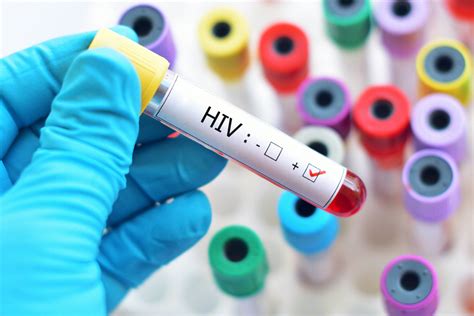 人类免疫缺陷病毒（HIV）HIV-1 和 HIV-2 - 料事通ivdmat