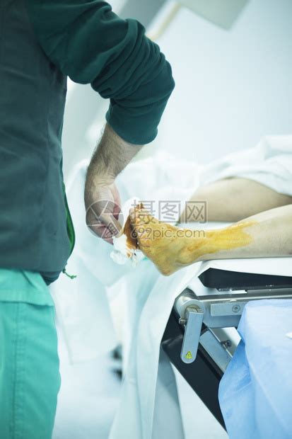 医院急诊骨科和创伤外科手术室医疗诊所真实生活照片在足踝和腿关节高清图片下载-正版图片502555749-摄图网
