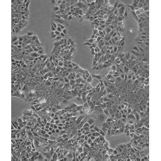 HCT-15/Taxol 人结肠癌紫杉醇耐药株-原代细胞-STR细胞-细胞培养基-赛百慷生物