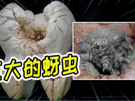 牙齿上的虫子图片