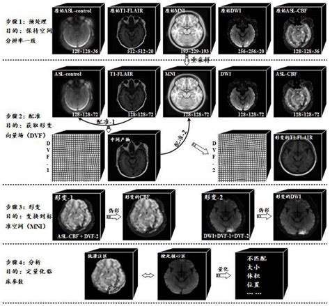 一种急性缺血性脑卒中磁共振灌注-弥散影像配准方法与流程