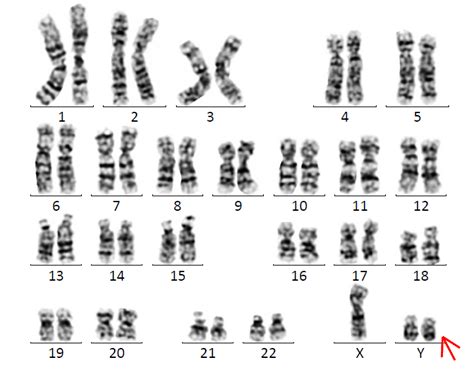关于染色体核型分析，你了解多少？这篇文章带你读懂染色体报告单_遗传