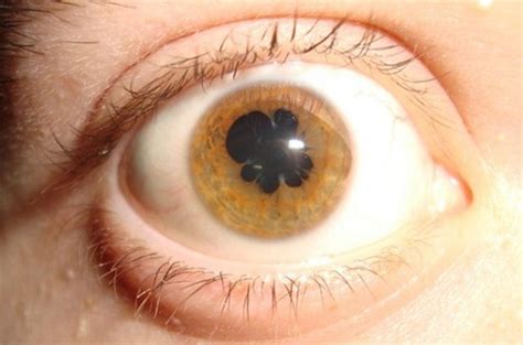 眼部疾病图片_眼部疾病症状表现图片大全_有来医生