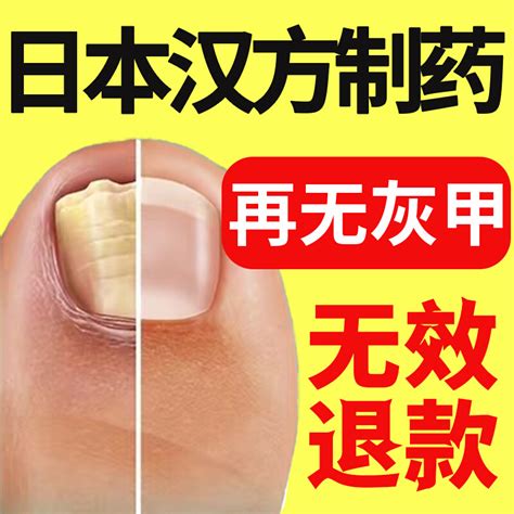 灰指甲特效药根治治疗亮甲正品专用药手指脚趾甲沟炎脱甲膏抑菌-淘宝网