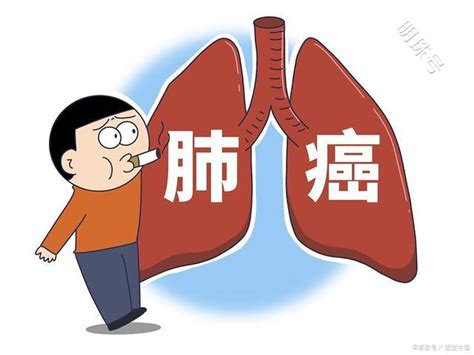 三个征兆说明已有肺癌-肺癌早期有三处痛图片 - 两性健康 - 华网