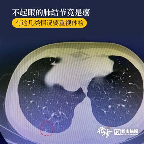 【新时代新作为新篇章】申城首家肺癌诊疗一体化中心挂牌 打造肺癌诊疗新模式_健康_新民网
