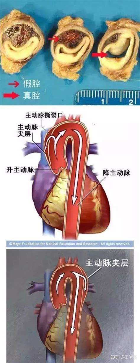 二十张图教你秒懂心血管疾病（医学生收藏） - 知乎