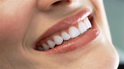 来宾口腔医院费用明细更新,内含来宾牙科矫正/种牙多少钱,种植牙-8682赴韩整形网