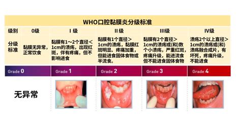 口腔上颚溃疡图片
