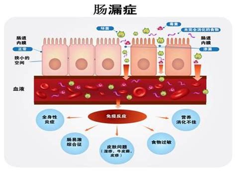 漏肠的症状图片