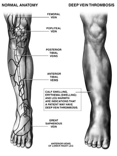 Difference between normal and abnormal legs | Download Scientific Diagram