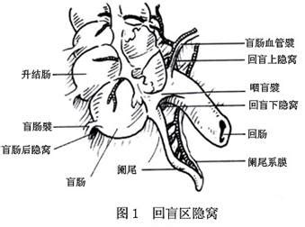 结肠隐窝,位置图,直肠隐窝的位置示意图_文秘苑图库