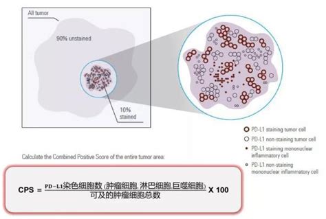 名家讲堂丨李忠武教授：结直肠癌分子分型及免疫治疗相关标志物-肿瘤瞭望