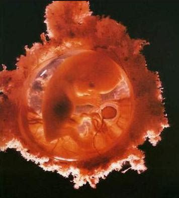 精子和卵子结合全过程(图)_亲子频道_凤凰网