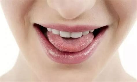 【为什么舌头上有红点点】【图】为什么舌头上有红点点呢 3种原因可造成舌上红点(2)_伊秀健康|yxlady.com