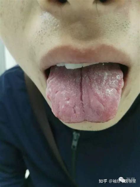 舌头正确应该放上颚吗？ - 知乎