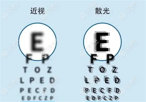 “散光”是怎么形成的？内附散光患者保护眼睛的6种方法 - 知乎
