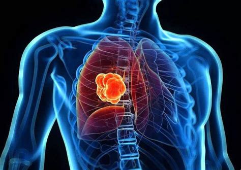 中医治疗肺癌-百度经验