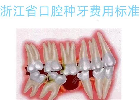 浙江医院口腔科看牙是否还需要核酸检测报告 | 杭城看牙记