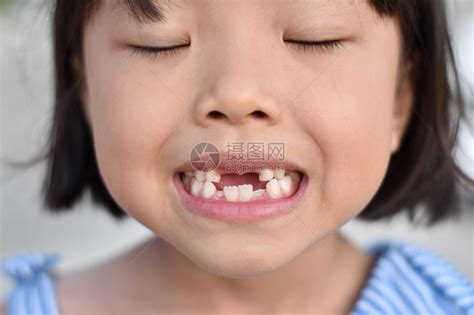 缺失门牙的小女孩高清图片下载-正版图片307717822-摄图网