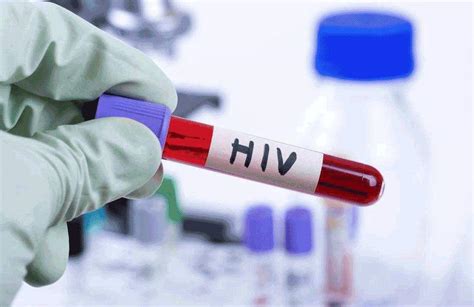 四项排出艾滋_艾滋病检测_艾测网