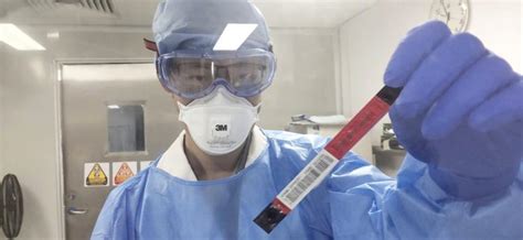 化学发光新冠病毒试剂盒研制成功：采血检测，22分钟出结果