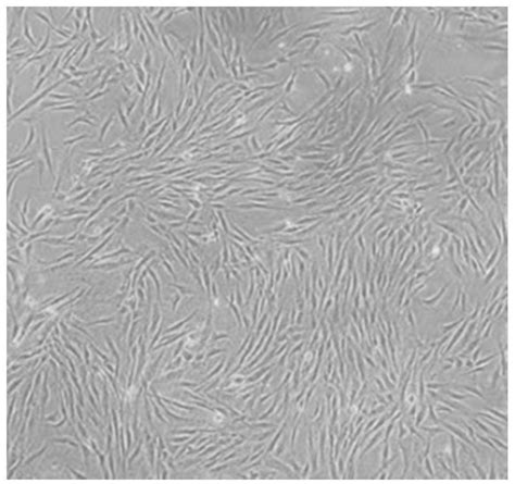 干细胞高效分化视网膜小胶质细胞|干细胞_新浪新闻