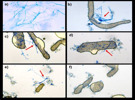 Microscopic images showing biocontrol effect of Paenibacillus sp. CCB36 ...