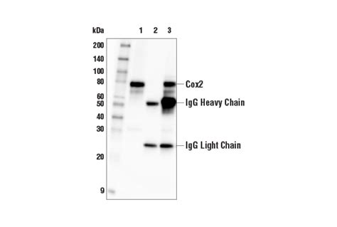 Cox2 (E7V6C) Mouse mAb | Cell Signaling Technology