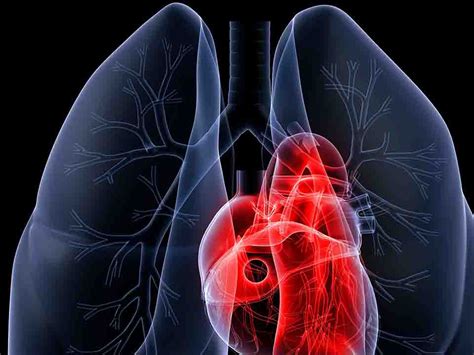 肺癌晚期死前症状图片-肺癌症状-复禾健康
