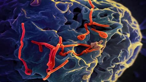 埃博拉病毒能够在幸存者体内长期潜伏，5年后仍可感染他人