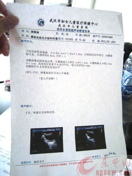 湘雅医院妇科超声检查报告-