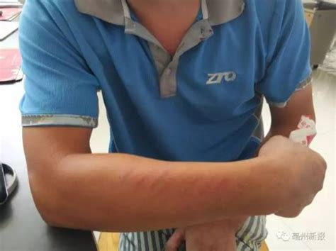 亳州一快递小哥被人摁地狂殴 打人男子被拘10日（图）_安徽新闻_新闻_