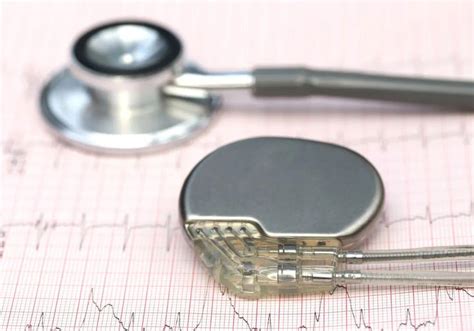 小心！无线心脏起搏器可能会要了你的命-医疗电子-与非网
