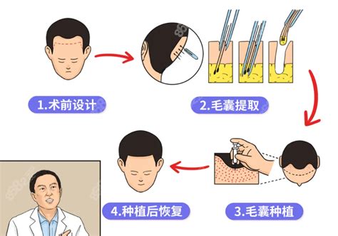广州青逸种植毛发医院如何?植发技术怎么样?附植发价格表-发友网