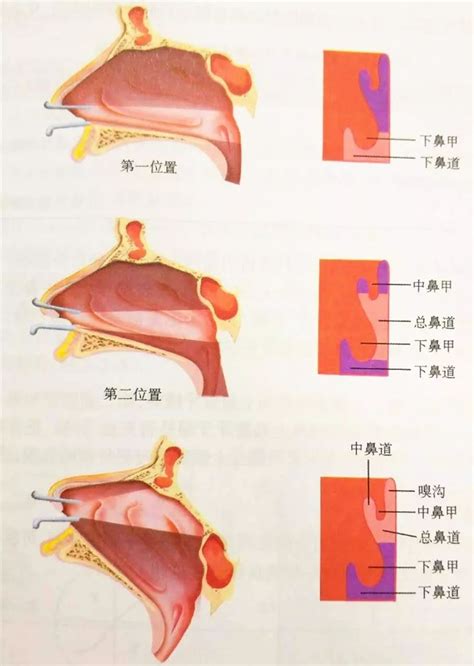 鼻的软骨解剖示意图-人体解剖图,_医学图库